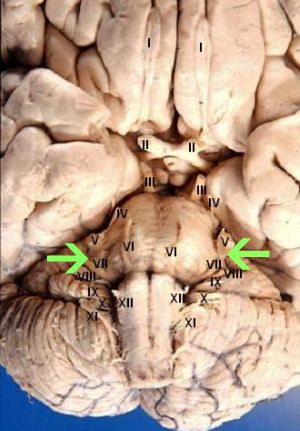 Cranial nerves